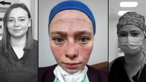 Türkiye’nin hafızasına kazınan fotoğraf! Seher hemşire: Maske kalktı ama izi ve hatıraları bizimle